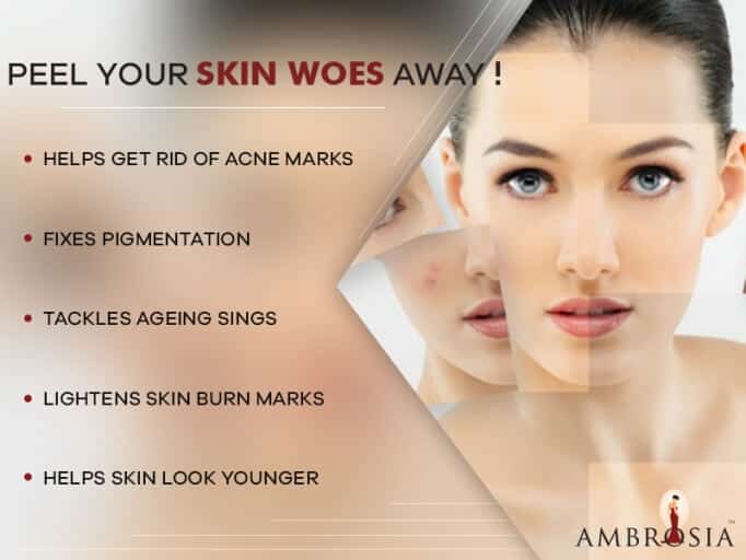 Peel Your Skin Woes Away