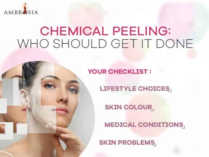  Who should get it done Chemical peeling
