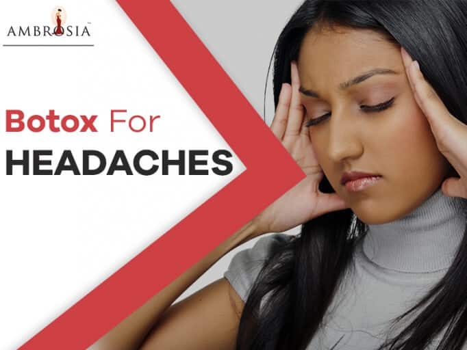 Botox for Migraines: Things to consider