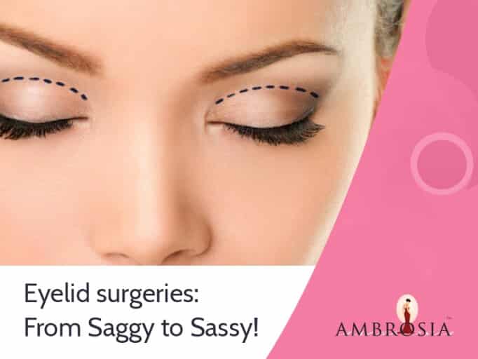 Eyelid-surgeries-From-Saggy-to-Sassy