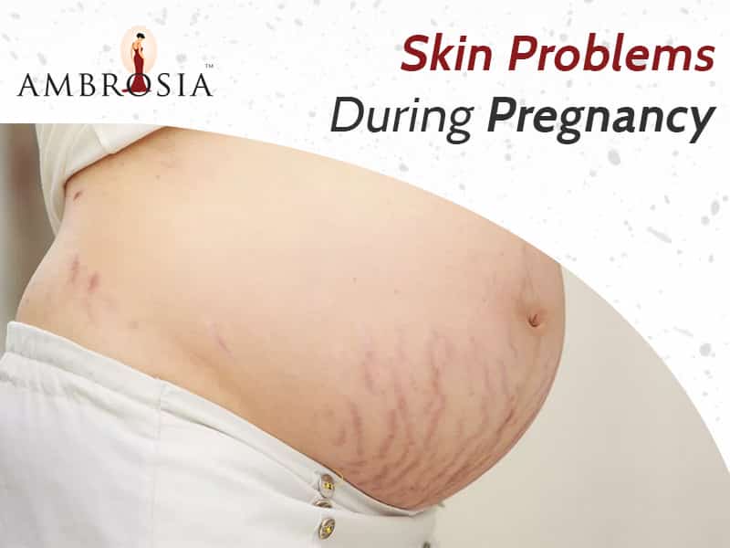 Skin Problems During Pregnancy – An Overview