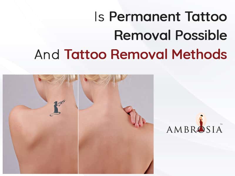 Is Permanent Tattoo Removal Possible And Tattoo Removal Methods