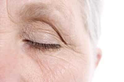  Ageing Eye Wrinkles.