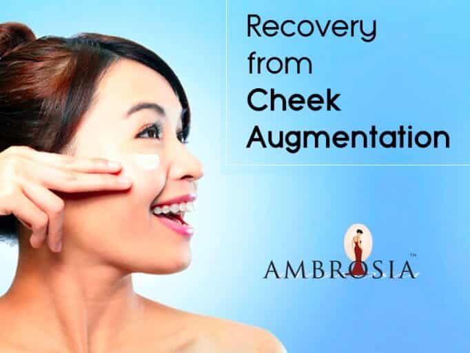 Recover From Cheek Augmentation, Like A Boss!
