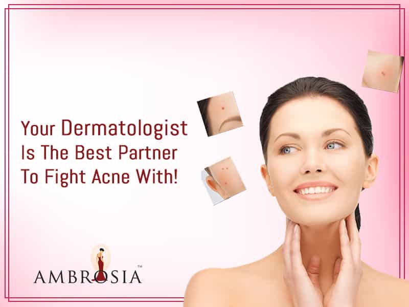 Your Dermatologist is The Best Partner to Fight Acne With