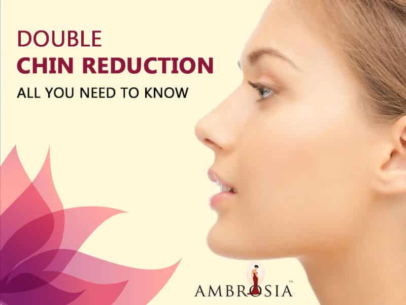Double Trouble: All You Need to Know About Double Chin Reduction