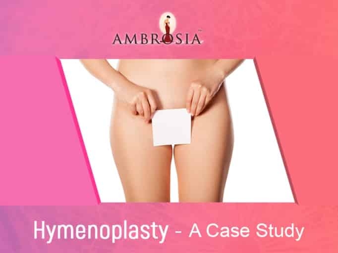 Hymenoplasty: It’s More Than Just Revirginising!