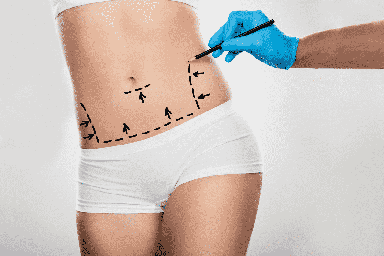 Abdominoplasty Surgery: Treatment, Procedure And Results
