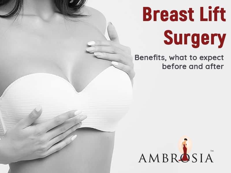 Breast Lift Surgery: Benefits, What To Expect Before And After
