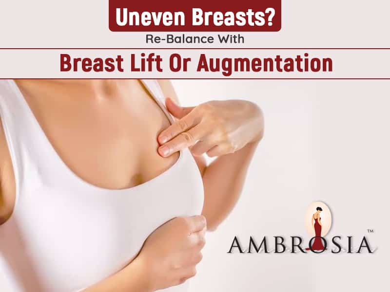 Breast Lift or Augmentation
