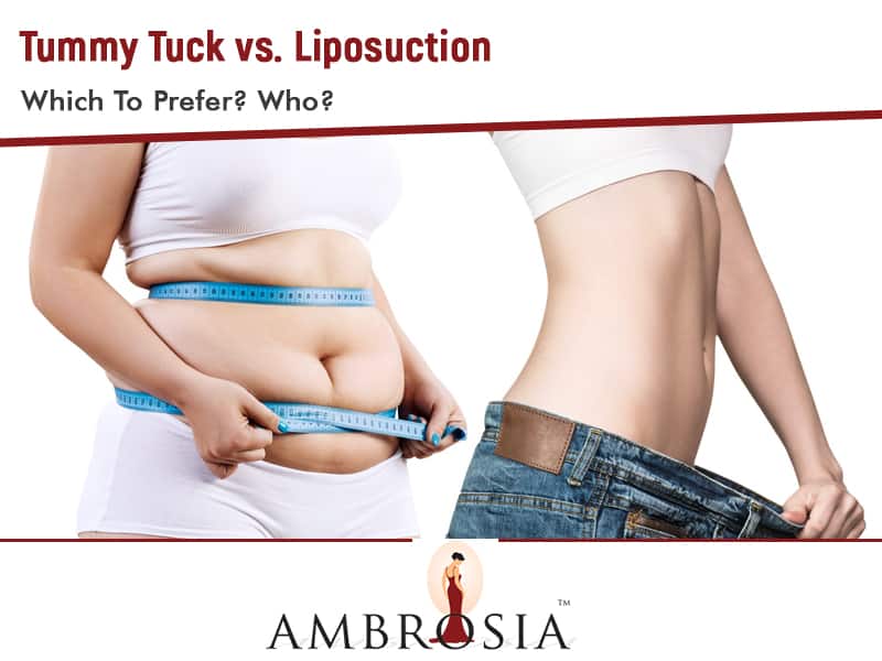 Tummy Tuck vs. Liposuction – Which To Prefer? Who?