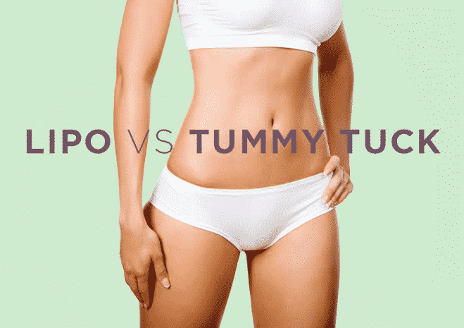 Tummy Tuck vs. Liposuction - Which To Prefer? Who?