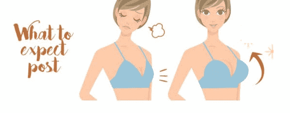 Uneven Breasts? Re-Balance With Breast Lift Or Augmentation