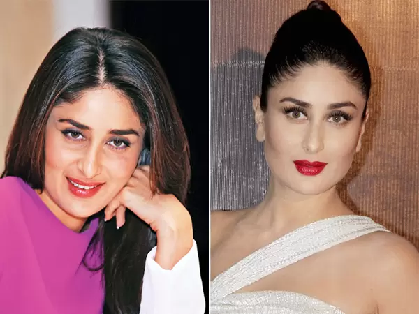 Kareena Kapoor - Before After botox surgery