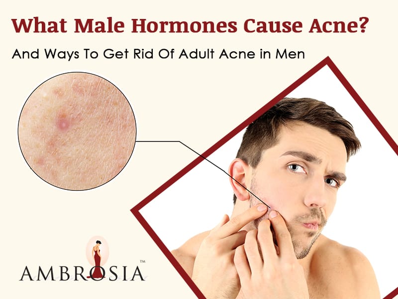 What Male Hormones Cause Acne? And Ways To Get Rid Of Adult Acne in Men