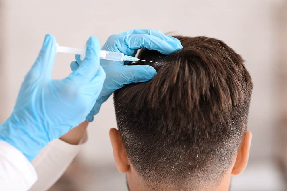 Unrecognizable Man Having Hair Treatment - Ambrosia Clinic