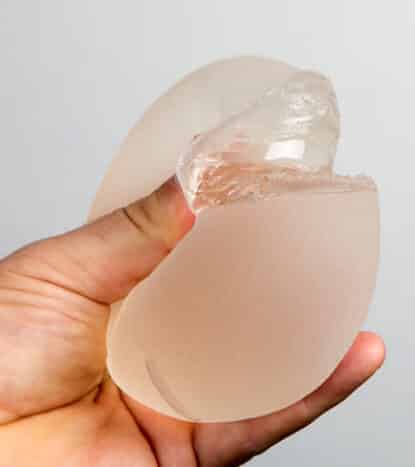 Round Breast Implants