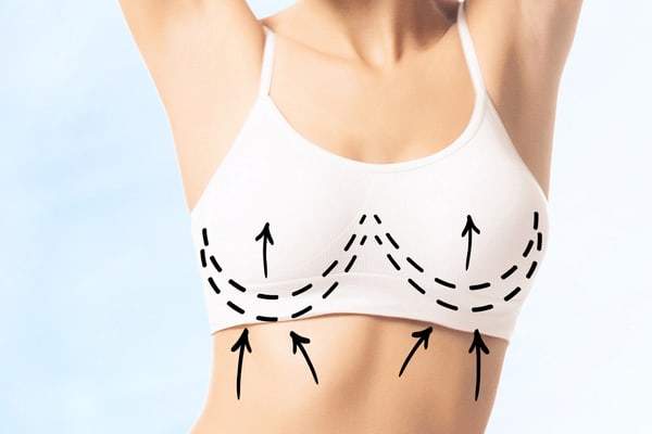 Breast Liposuction
