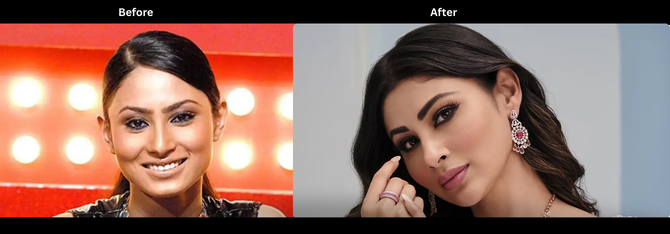 Mouni Roy Then vs Now : What Skin Experts Say About Celebrity Skin Transformations